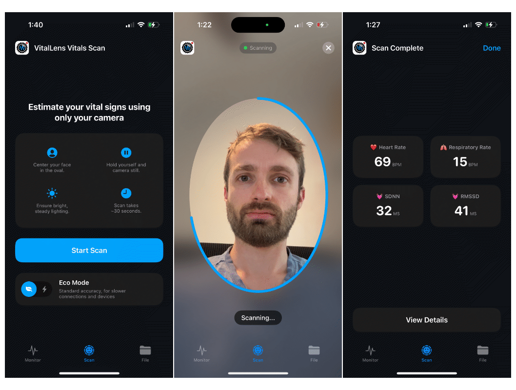 Introducing vitallens-ios